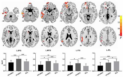 Differential Regional Brain Spontaneous Activity in Subgroups of Mild Cognitive Impairment